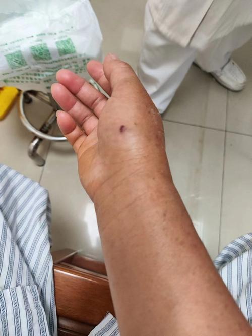 新澳2025今晚开奖结果和女子遭毒蛇咬伤身亡与女子遭毒蛇咬伤身亡视频