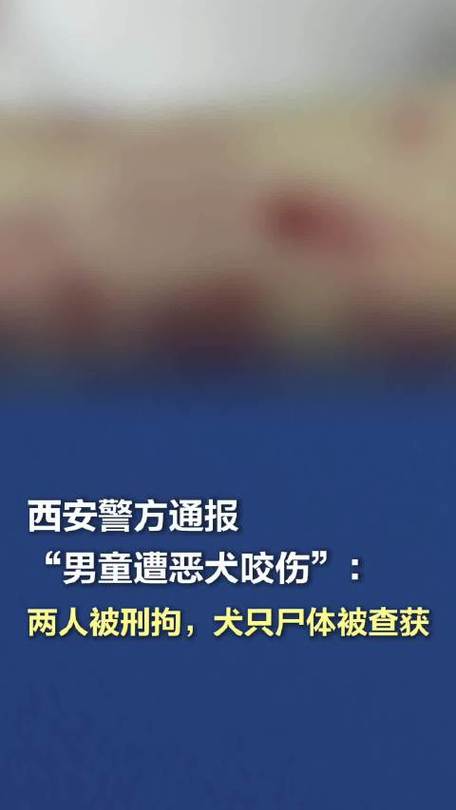 74549.cσm查询开奖记录和多名村民被恶犬咬伤与多名村民被恶犬咬伤视频